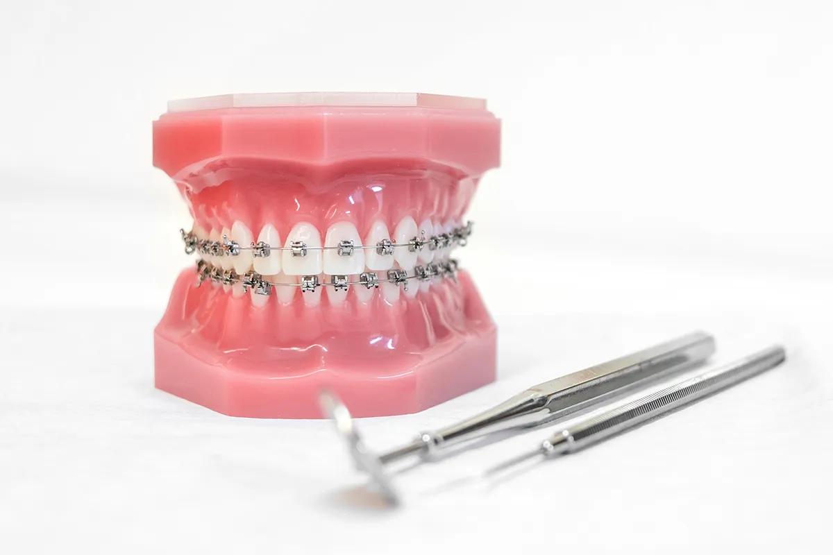 urgence orthodontique à Lyon Dr Lietz